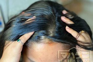 髪が傷み頭の臭いが取れず困っておりヘナやハーブシャンプーで解消したい