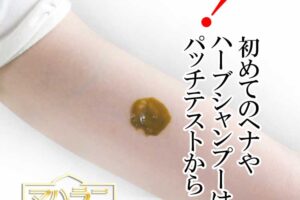 植物アレルギーとパッチテスト